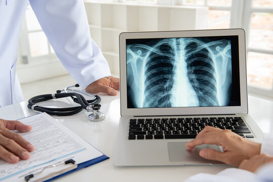 doctor diagnose lung x-ray image on digital tablet screen with radiologic technologist team.