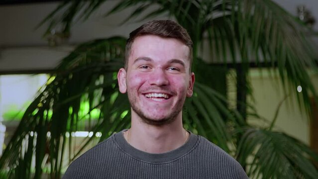 Close-up of a young man with pimples on his face. The guy laughs. Problematic skin