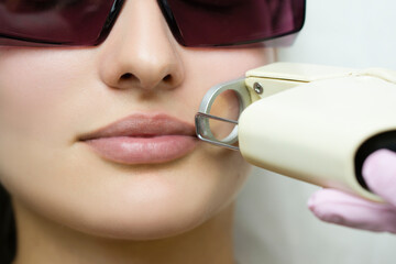 Facial care. Laser hair removal for the face. woman gets facial hair removal procedure.