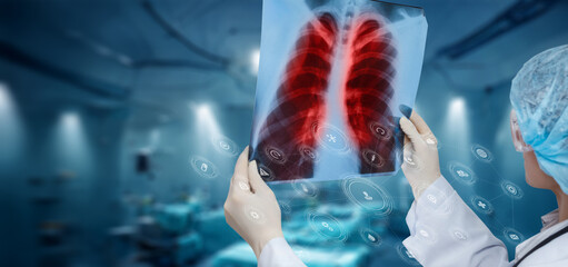 Doctor examining a snapshot of the lungs in the office .