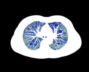 CT scan of Chest or lung  at radiology department in hospital. Covid-19 scan body xray test detection for covid virus epidemic spread concept