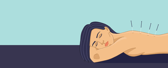 Peaceful lying woman doing acupuncture on her back for her health. Acupuncture banner illustration