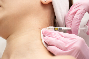 A woman is given beauty injections, a filler is injected into the wrinkles of the skin of the neck. close-up injections filling with filler circles of venus on the neck. real procedure.