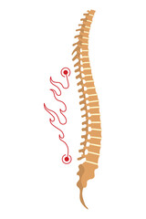 Spinal deformity. Symbol of spine curvatures or unhealthy backbones. Human spine anatomy, curved spine. Diagram with marked section. Body posture defect