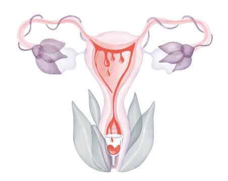 Menstrual cup inside of uterus,  feminine hygiene product, collecting blood during period, used inside of vagina of the woman, body positivity, cervix diagram, eco friendly reusable product