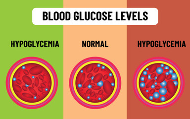 Blood glucose levels. hunger satiety, sugar level