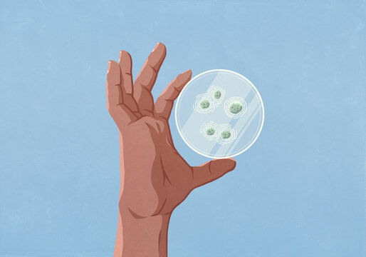 Close up hand holding petri dish with bacteria
