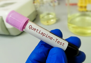 Quetiapine is an antipsychotic drug indicated for the treatment of schizophrenia and bipolar disorder. Quetiapine test to set a therapeutic range.