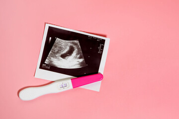 Photo of ultrasound and pregnancy test on a pastel pink background. Positive pregnancy test
