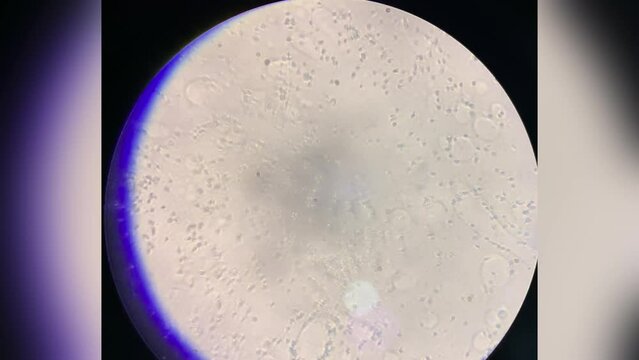 Human sperm under microscope 40x magnification, macro view through microscope on slide with many spermatozoa.