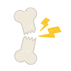 手描きの骨折イラスト