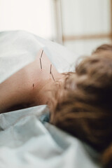 Woman stabbed in the back with needle in bright acupuncture clinic