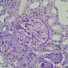 Camera photo of normal glomeruli and renal tubules, PAS stain, magnification 400x, photograph through a microscope