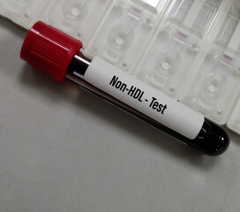 Blood sample for Non-HDL test. Good cholesterol. CKD