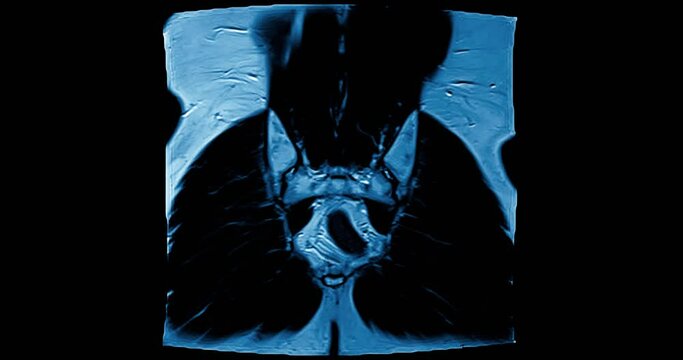 Medical Scan Showing Human Body Part While Scanning