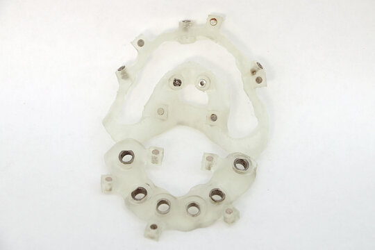 Collapsible printed dental surgical template. Navigational surgical guide for dental implantation