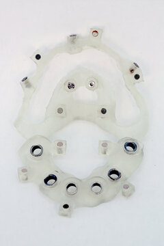 Collapsible printed dental surgical template. Navigational surgical guide for dental implantation