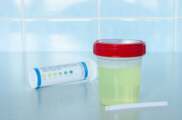 a urine test jar with test strips to determine the protein in the urine