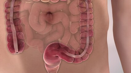 Gut Zoom In with Hairy Germs and Flagella