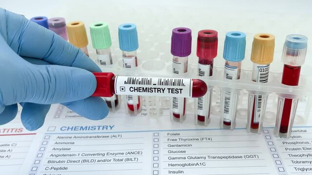 Technician lab holding Blood sample tube for analysis of blood chemistry study in the laboratory. Lab technician assistant or doctor holding Blood testing over requisition report for blood chemistry t