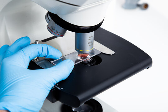 microscope blood sample at the medicine and medical laboratory