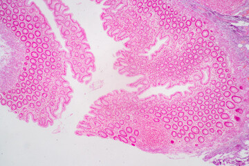 Backgrounds of Characteristics Tissue of Stomach Human, Small intestine Human, Pancreas Human and Large intestine Human under the microscope in Lab.