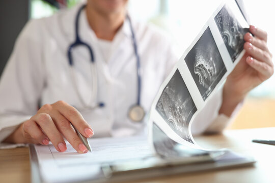 Female doctor looking at description of ultrasound shots of patient