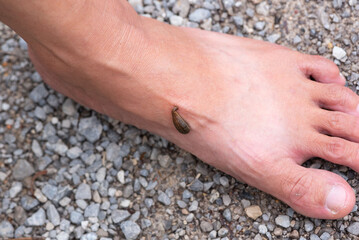 A leech sucking blood on the foot.
