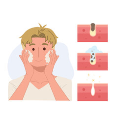Facial care, skin defects, skin problems, acne, facials. Face Care man concept. Step of remove acne. Vector illustration.