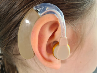 Closeup of hearing aid in ear of child girl