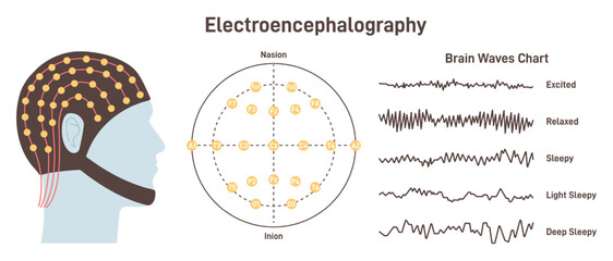 Electroencephalography. Medical test that measures electrical activity © inspiring.team