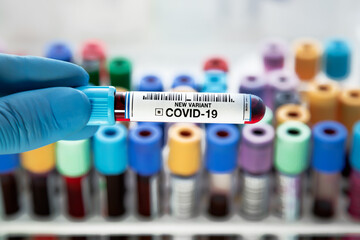 Technician with blood test tube to coronavirus analyze in the research lab. Researcher holding...