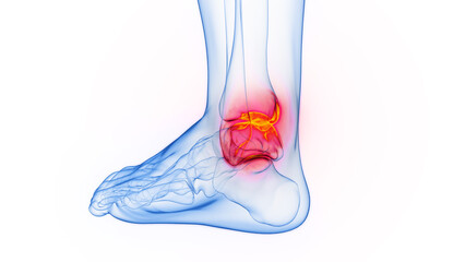 3D rendered Medical Illustration of Male Anatomy - Inflamed Ankle. Plain White Background.