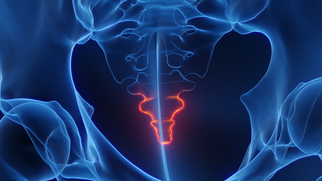 3D rendered Medical Illustration of Male Anatomy - Inflamed Coccyx.