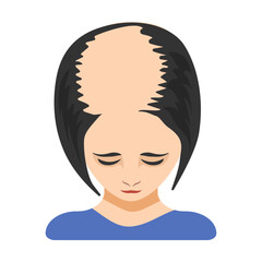Four stage of alopecia in women vector illustration. Top of female head with bald spot on scalp isolated on white background. Health, hair loss or treatment