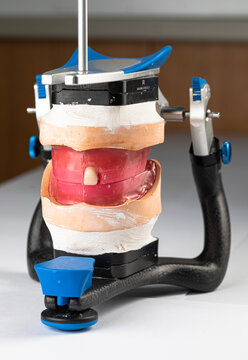 Dental articulator with dental models and dental total prosthesis