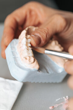 Dental Technician Making Ceramic Crowns