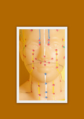 Banner with Medical acupuncture model of human