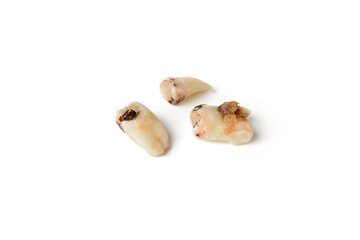 Pulled out teeth affected by caries, the concept of dentistry and hygiene.