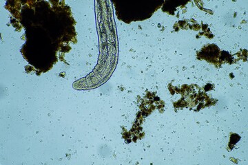 microorganisms and soil biology, with nematodes and fungi under the microscope. in a soil and...