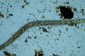 microorganisms and soil biology, with nematodes and fungi under the microscope. in a soil and...