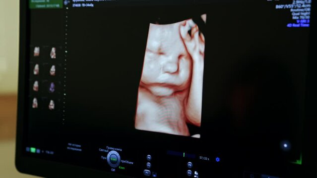 Image of unborn baby holding his hand on the head. Cute 3d picture of a child on the last stages of pregnancy on ultrasound machine. Close up.