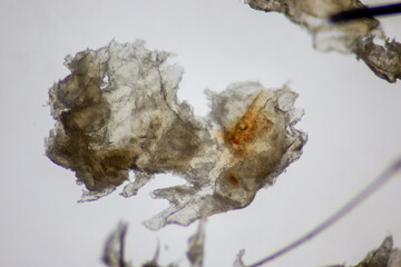 Fungus from the scalp Human under the microscope.