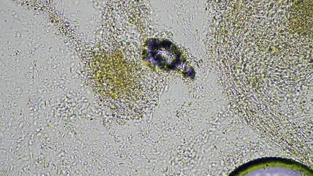 baby feces under the microscope looking at poo with bacteria and bugs in a laboratory