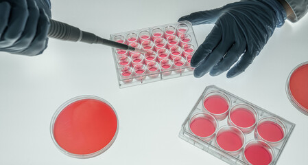 laboratory assistant in a microbiological laboratory doing PCR DNA analysis of biological samples...