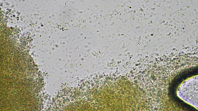 baby feces under the microscope looking at poo with bacteria and bugs in a laboratory