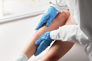 Female doctor examining patient's bruised leg in clinic