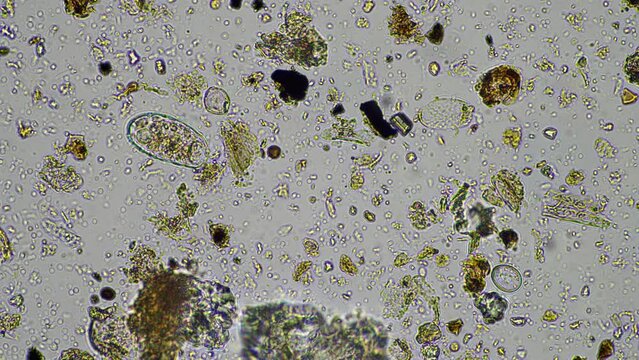 soil microbes organisms in a soil and compost sample, fungus and fungi and under the microscope in regenerative agriculture. in australia.