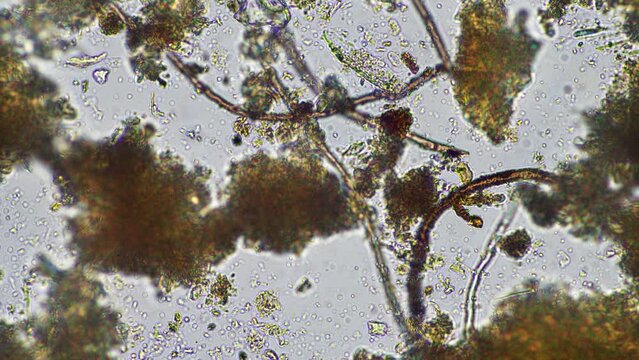 microorganisms and soil biology, with nematodes and fungi under the microscope. in a soil and compost sample