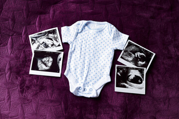 Children's clothing and photo ultrasound